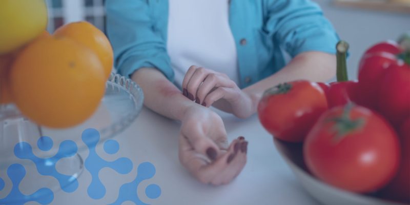 Gıda Alerji Testi